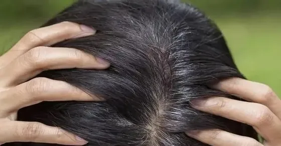 Wellhealthorganic.com know the causes of white hair and easy ways to prevent it naturally